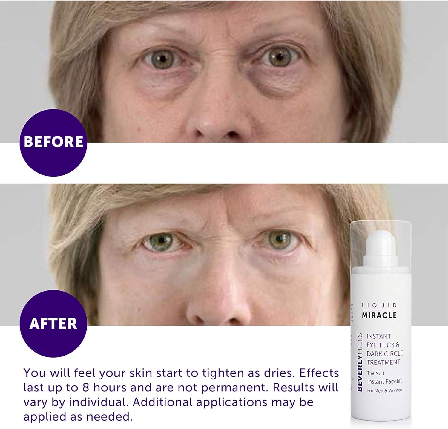 beverly hills instant facelift