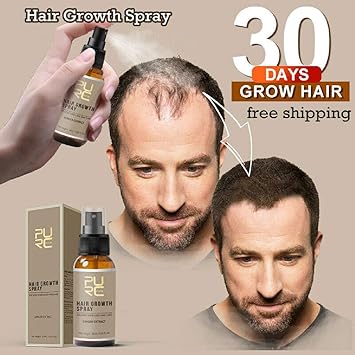 Amazon Com Miracle Hair Growth Spray Stcorps7 30 Day Hair