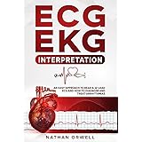 Ecg Workout Exercises In Arrhythmia Interpretation Huff Jane 9781469899817 Amazon Com Books