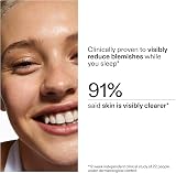 The INKEY List Blemish Clearing Moisturiser 50ml Fragrance Free Normal Oily Skin view 6
