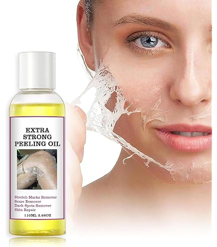 Amazon.com: LHALA Doctor Facial Peeling Solution, 10ml / 0.34 fl