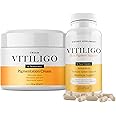 Dermawonder Vitiligo Supplement & Pigmentation Cream Set | 60 Vitiligo Capsules and 4fl Oz Cream | Reduce White Spots, Improve Skin Pigmentation & Neutralize Skin Tone | Natural Solution (1)