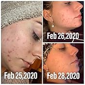 Download Amazon Com Dermashine Pro Wireless 7 Color Led Mask For Face Photon Red Light For Healthy Skin Rejuvenation Therapy Collagen Anti Aging Wrinkles Scarring Korean Skin Care Facial Skin Care Mask Beauty Yellowimages Mockups