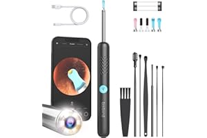 BEBIRD Ear Wax Removal Tool with HD Camera - R1 Upgraded Smart Visual Ear Cleaner with Otoscope, Ear Viewer with 6 LED Light & Multi Replacement Tips for Cleaning Earwax & Inspection Kits