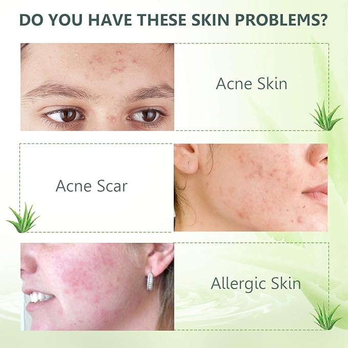 aloe vera gel good for scars