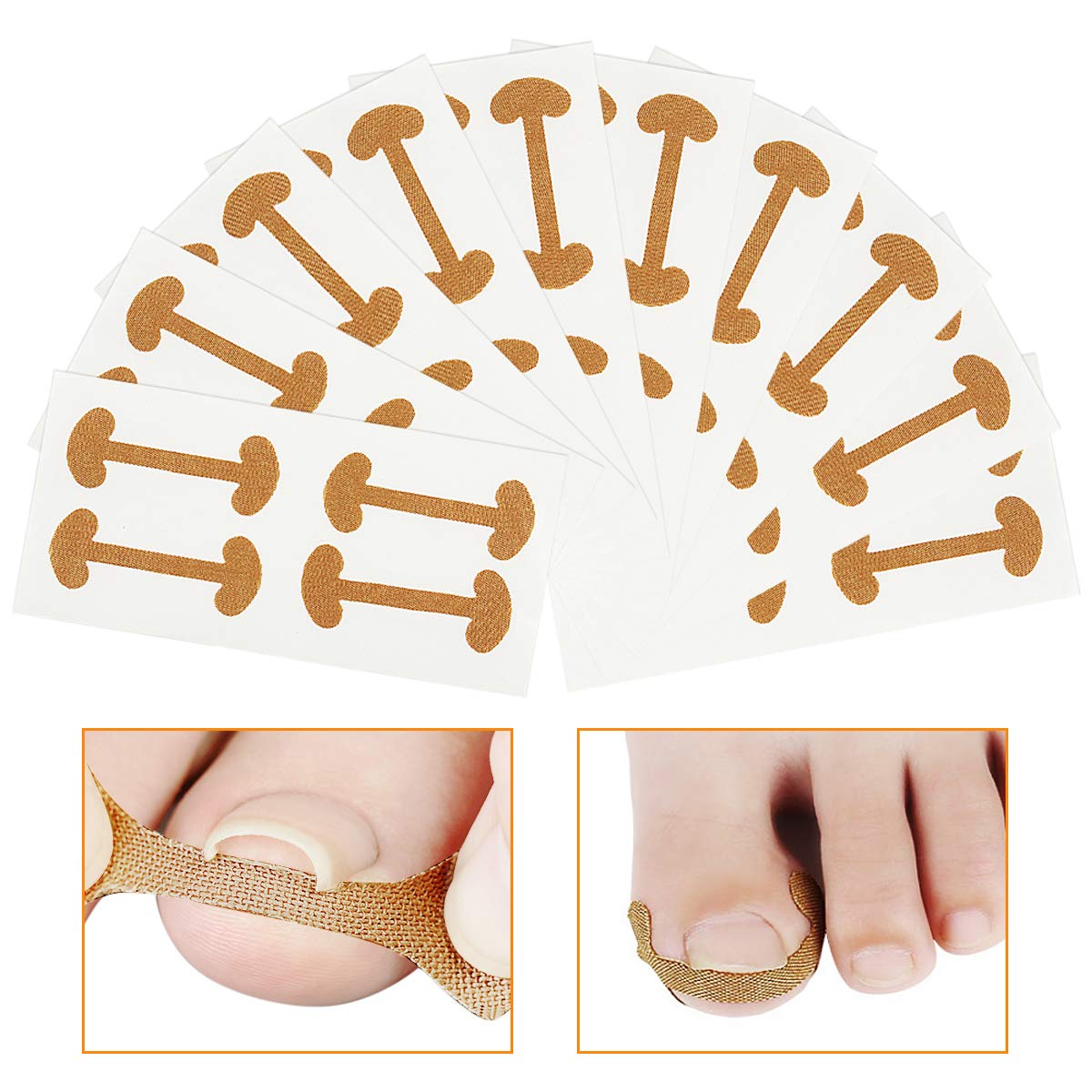 40 PCS Ingrown Toenail Corrector Stickers Breathable Self-Adhesive Elastic Toenail Correction Patch for Toenail Treatment Fingernail Care Protect Toe Nail