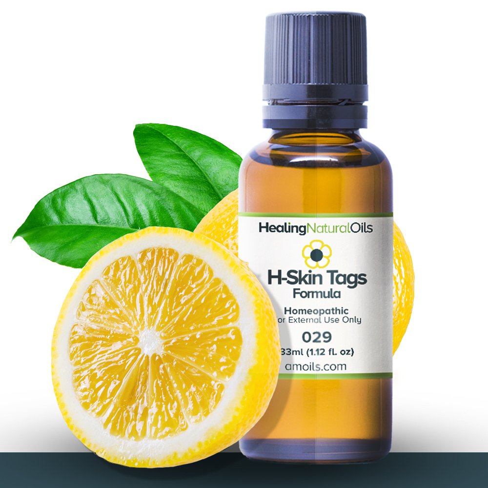 Skin Tag Removal Alternative 11ml size. A Powerful Blend of Safe, Gentle Natural Ingredients for Effective Skin Tag Treatment. No Cream, Tape or Remover Kits. Designed to Remove Skin Tags At Home : Therapeutic Skin Care Products : Beauty