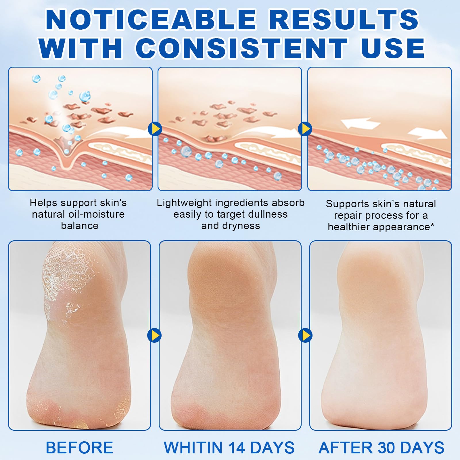 60% Urea Cream Stick plus 2% Salicylic Acid, Maximum Strength Urea Foot Cream Callus Remover for Dry Cracked Heels, Hands, Knees,Exfoliating Moisturizer, Dead Skin Remover Foot Balm 1.4oz (1pcs)