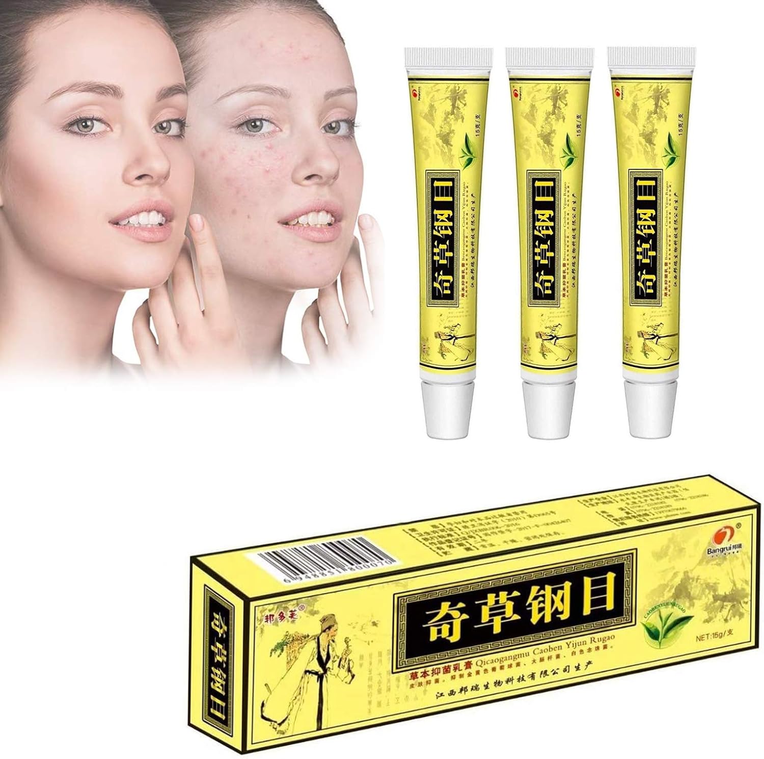 Chinese Herbal Skin Care Cream Skin, Dermatitis Ointment, Skin Problem