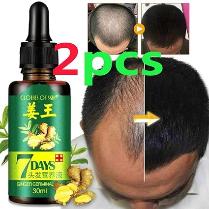 Amazon Com Ginger Hair Regrowth Oil Ginger Germinal Essential