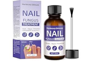 Lindesa 1Pcs 30Ml Toenail Fungus Treatment,Nail Fungus Treatment Extra Strength for Athletes Foot, Thick, Broken, Discolored & Damaged Nail - Safely and Gently., Blue