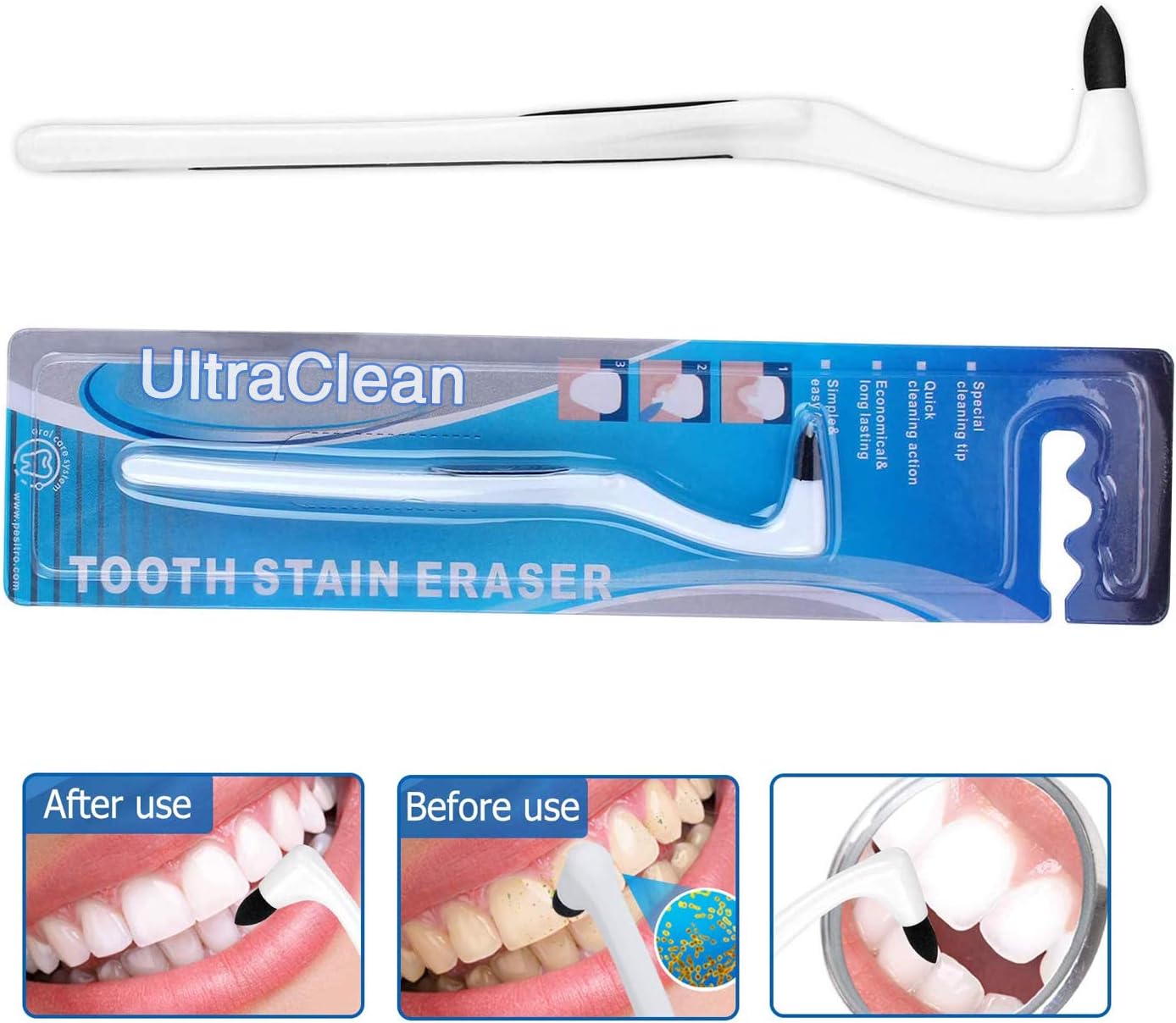 KKshop Tooth Stain Eraser, Teeth Polishing, Tooth Stain Remover, Teeth Cleaning Kit Whitening Oral Hygiene Care Tool - Image 5