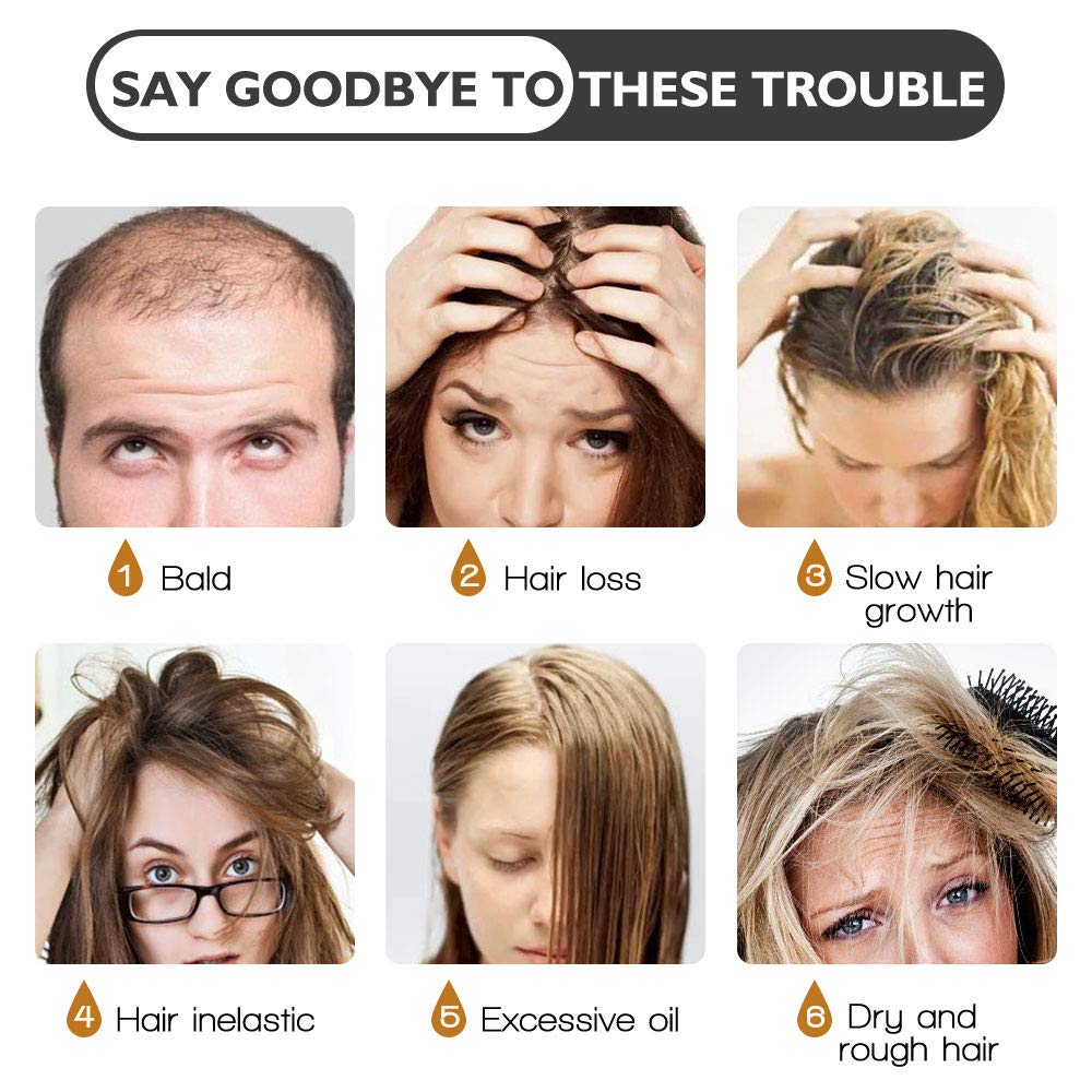 Hair Growth Serum, Ginger Hair Growth Oil, Anti Hair Loss Serum, Hair Loss Treatment for Thinning Hair, Promote Hair Growth, Strengthen Hair Roots Thickening & Regrowth Product for Women & Men (30ml) : Beauty