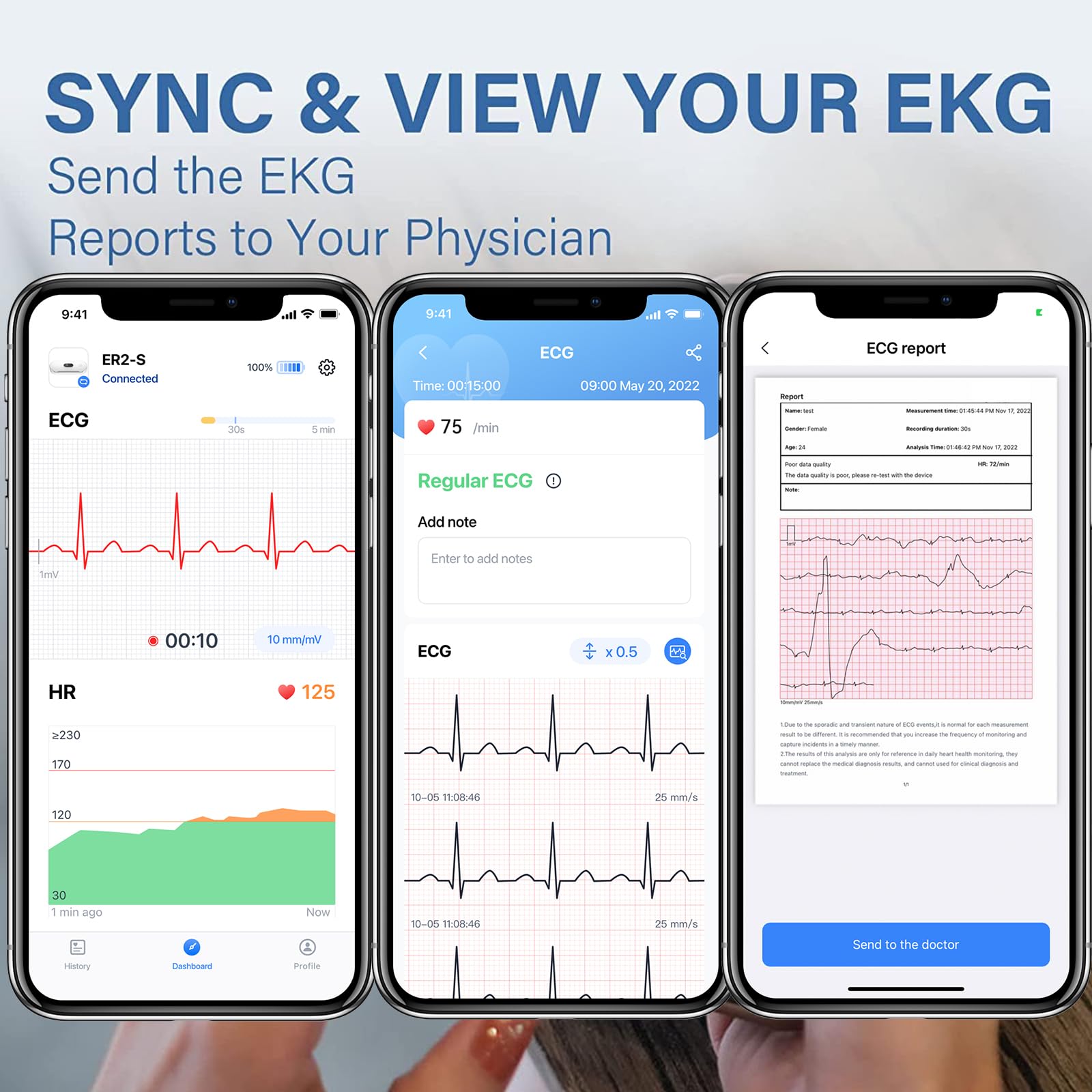 CheckMe DuoEK-S Mobiles EKG Gerät, Wireless Bluetooth EKG Messgerät mit Analysebericht, 0,96 Zoll OLED-Bildschirm, 30s - 5 mins, Herzfrequenzmonitor, APP für iOS/Android 4