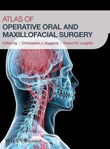 Maxfax Atlas of Operative Oral and Maxillofacial Surgery in Oman | Whizz Oral ...