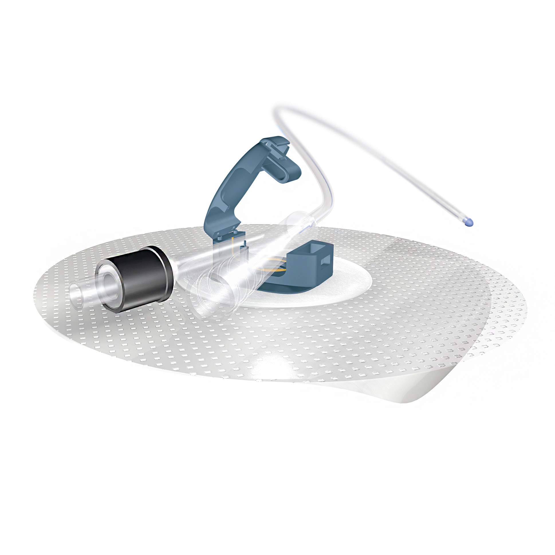 Ugo Fix Gentle (x5) – Catheter and Leg Bag External Securement Clip with Silicone Technology, Easily Adheres to Your Skin with no Preparation Needed (Pack of 5)