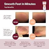 Own Harmony Electric Foot Callus Remover with 3 Diamond Rollers - USB view 2