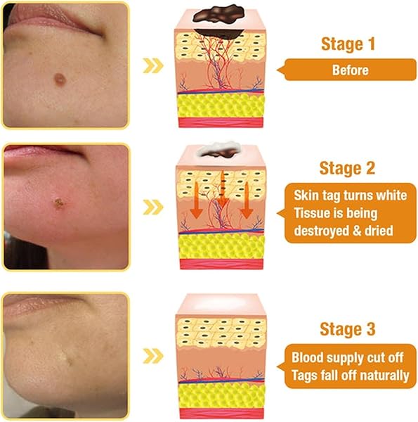 NCHAMPIONBA BEE VENOM CREAM, PROFESSIONAL BEE VENOM REPAIR CREAM, NATURAL SKIN MOISTURIZER, NEW BEE VENOM SKIN CREAM FOR ALL SKIN TYPES (2PCS)