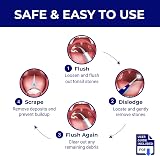 ORAVIX Tonsil Stone Remover Kit - 7 Piece Oral Care Set view 6