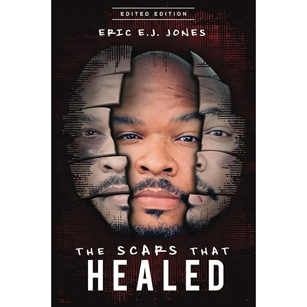 Amazon.com: The Scars That Healed: 9781648101984: Jones, Eric
