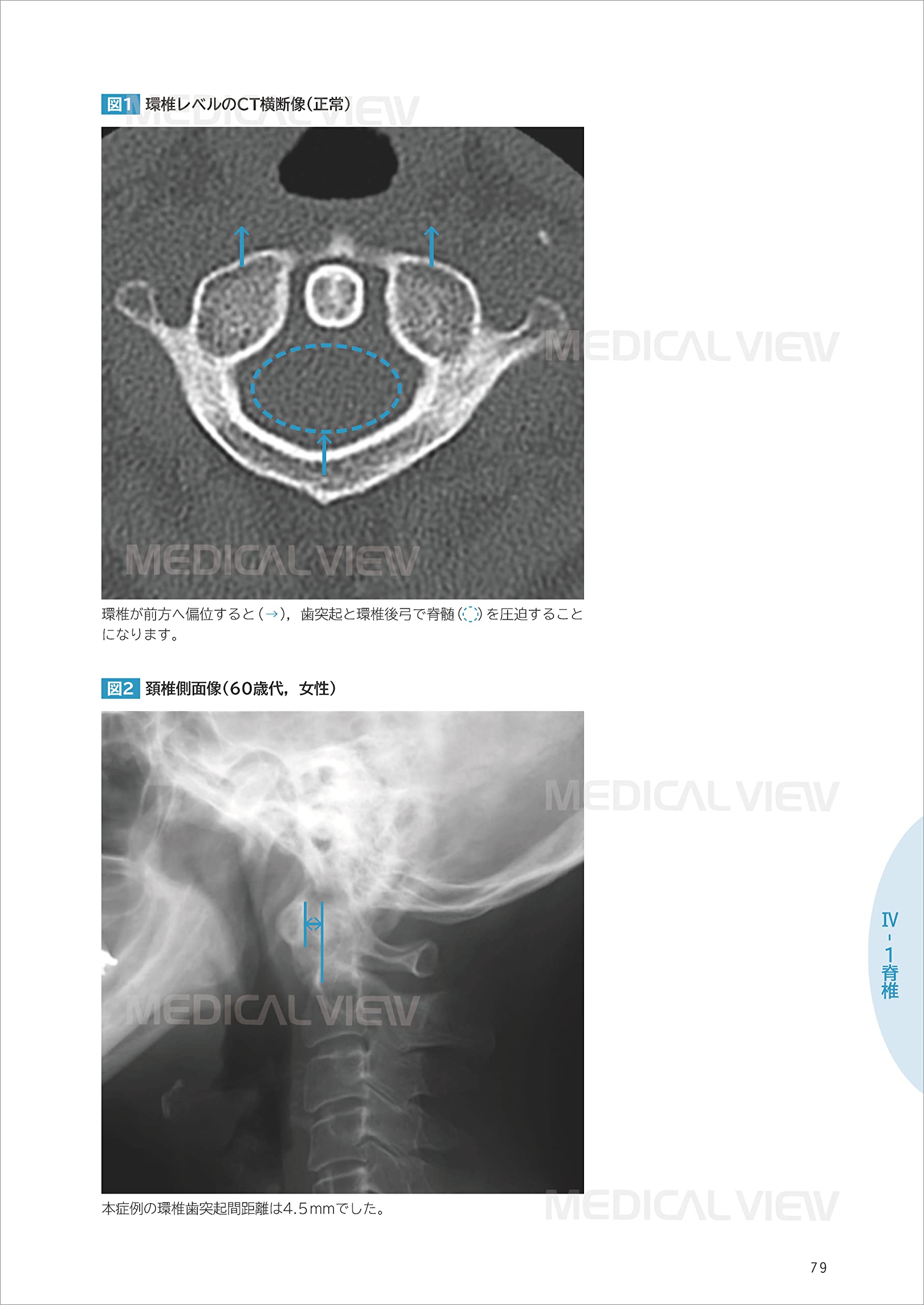 リハで読むべき運動器画像 瀧田 勇二 塩野 寛大 本 通販 Amazon リハで読むべき運動器画像 瀧田 勇二 塩野 寛大 本 通販 Amazon