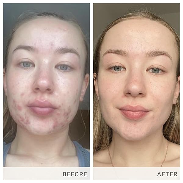 ADVANCED NUTRITION PROGRAMME SKIN ACCUMAX SUPPLEMENT DISTRIBUTED BY JANE IREDALE, 30-DAY SUPPLY