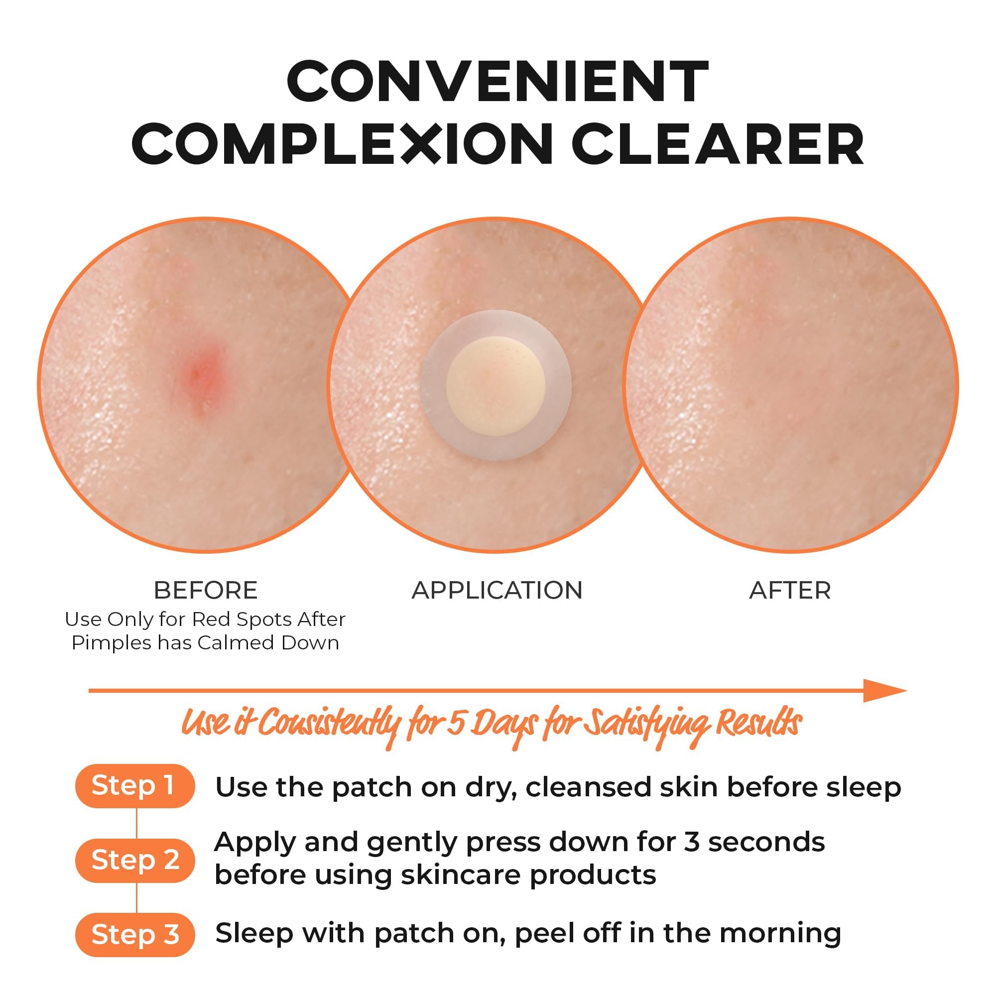 NOLAHOUR Spot Eraser Orange Microneedle Patch Vitamin C Glutathione Niacinamide Hardened Microneedle, Pack of 12, Acne Patch