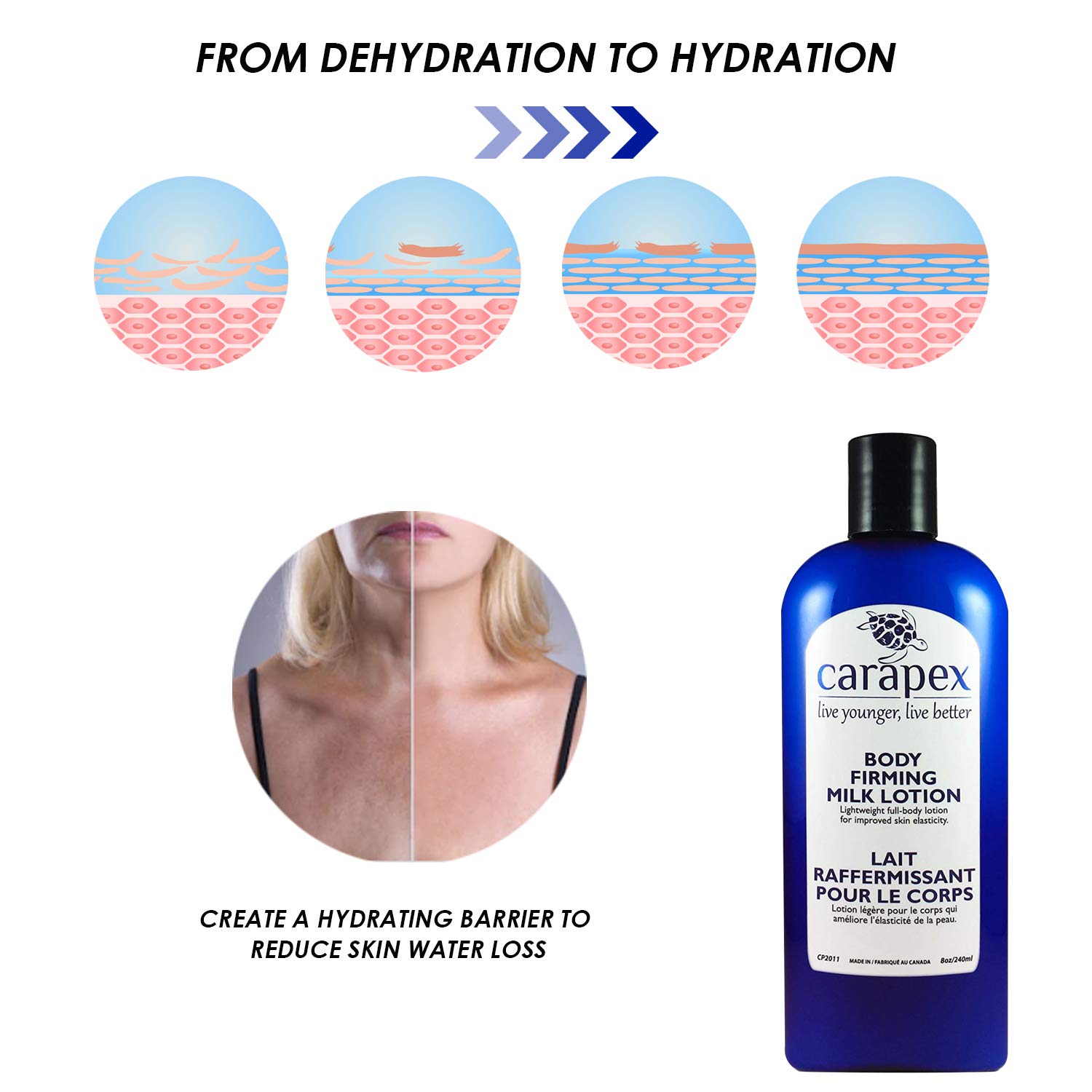 lotion for skin elasticity