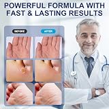 MYMULIKE Liquid for Corn Removers Extra Strength Foot Pain Relief 15ML view 4