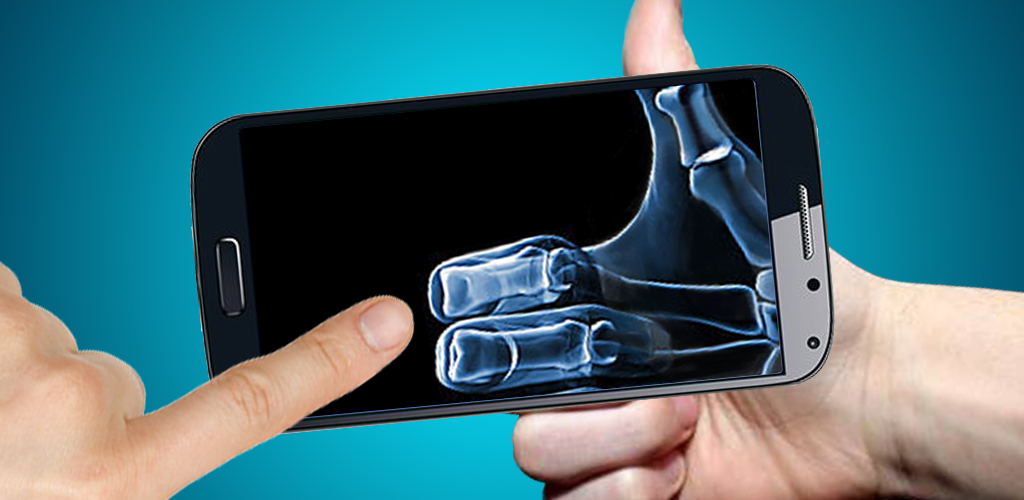 The XRay for Android