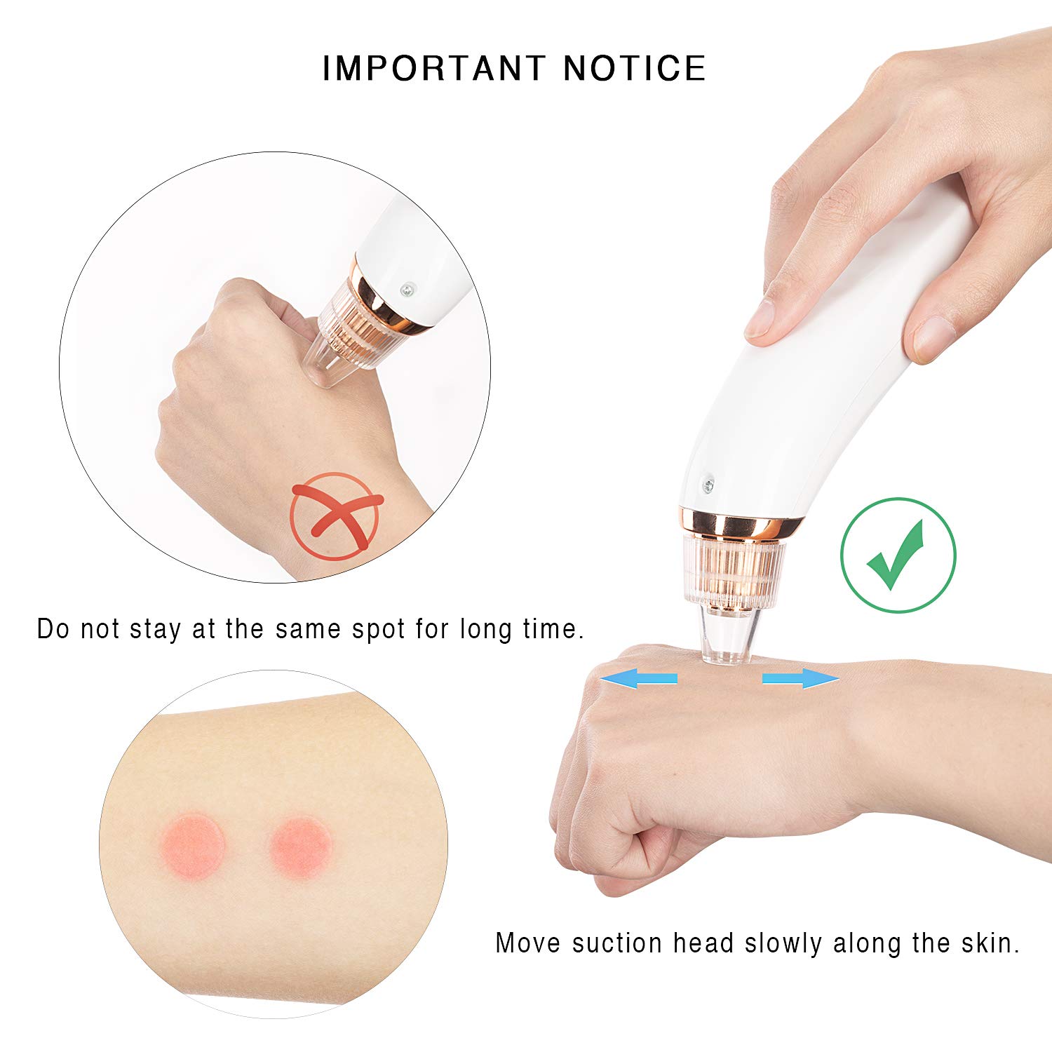 Blackhead Remover Pore Vacuum,ZAOZAOZAN Black Head Removal Tool USB Rechargeable for Blackhead Whitehead,3 Adjustable Suction Power and 4 Porbes: Beauty