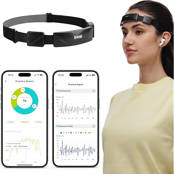 Amazon.com: Fabrication GSR Galvanic Skin Responses Biofeedback