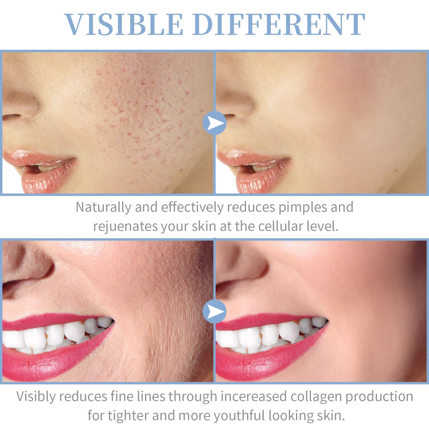 High Frequency Facial Machine - TUMAKOU Portable Handheld High Frequency Facial Skin Wand Machine with 4 Different Tubes: Beauty