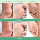 Plantifique Peach Foot Peel Mask 2 Pairs Exfoliating Dermatologist Tested view 3