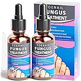 Toenail Fungus Treatment, Toenail Fungus Treatment Extra Strength, and Foot Fungus Treatment Extra Strength—plus Safely & Gently Nail Repair for Toenails and Fingernails (2-Pack) with File