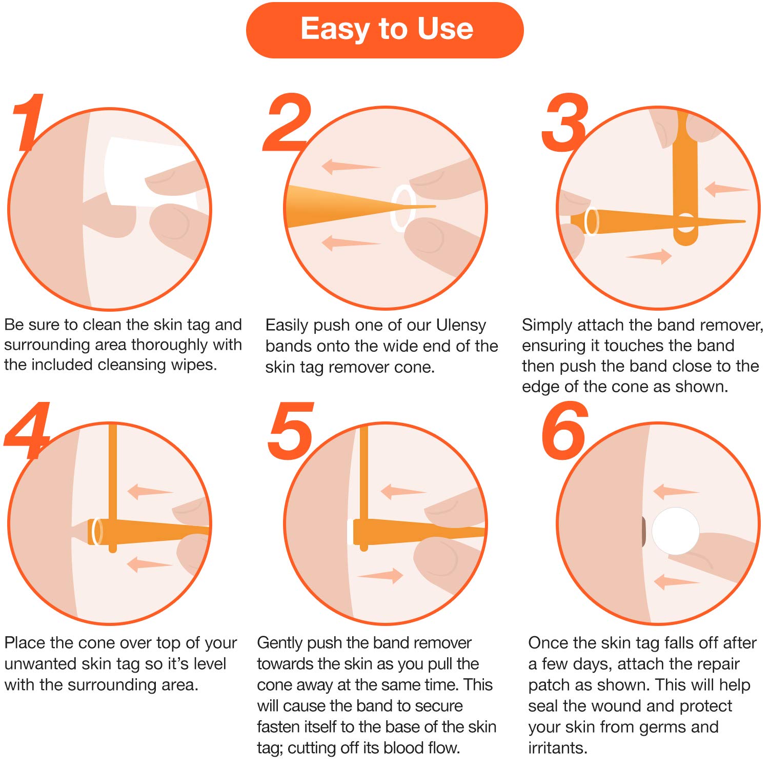 Ulensy Skin Tag Remover, Standard Skin Tag Removal Kit with 36Pcs Repair Patches for Face, Neck, Finger and Body, for Medium to Large (4mm to 8mm) Sized Skin Tags, Safe and Painless, Smooth Results : Beauty