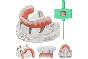 Dental Teaching Model, All-on-4 Overdenture Implant, Upper Jaw,Transparent