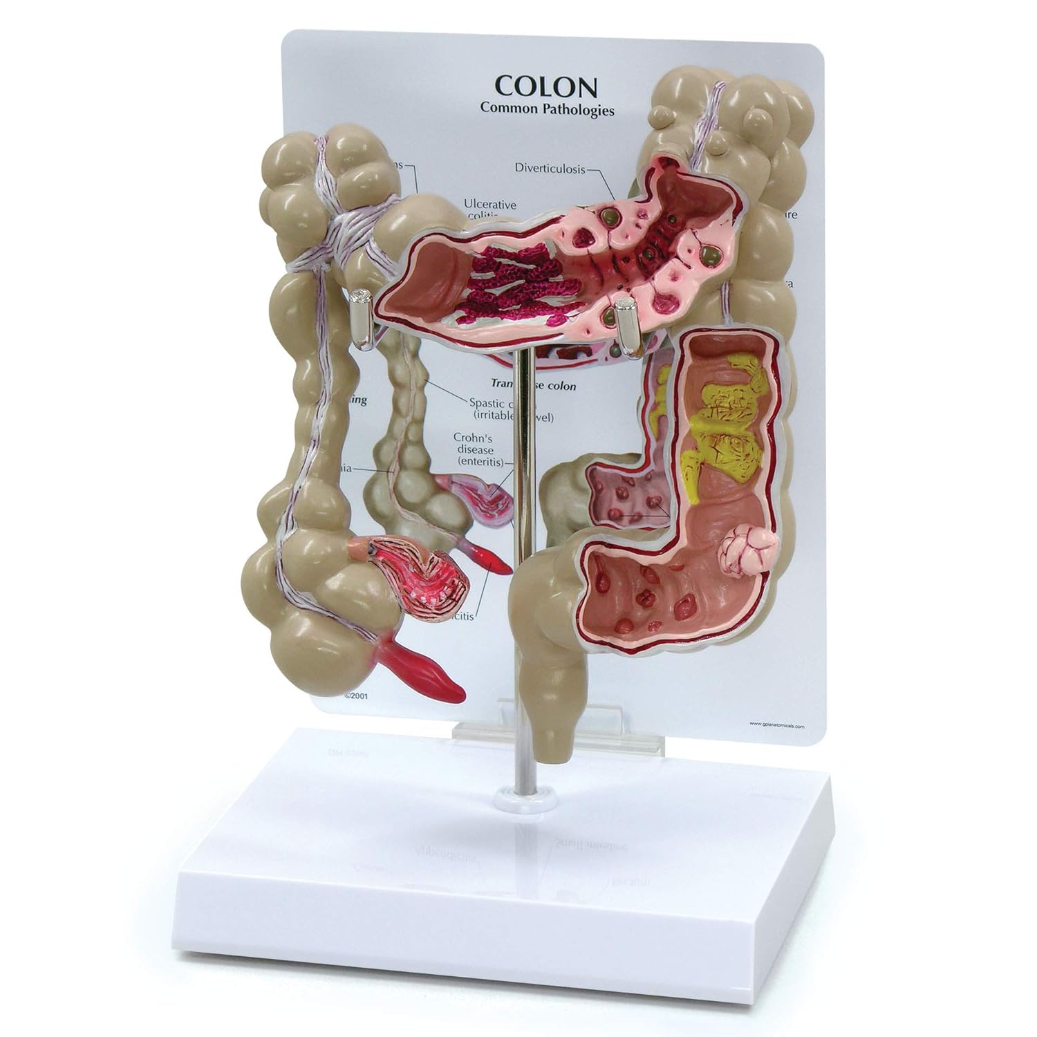 Amazon.com: Colon Model | Human Body Anatomy Replica of Colon w/Common