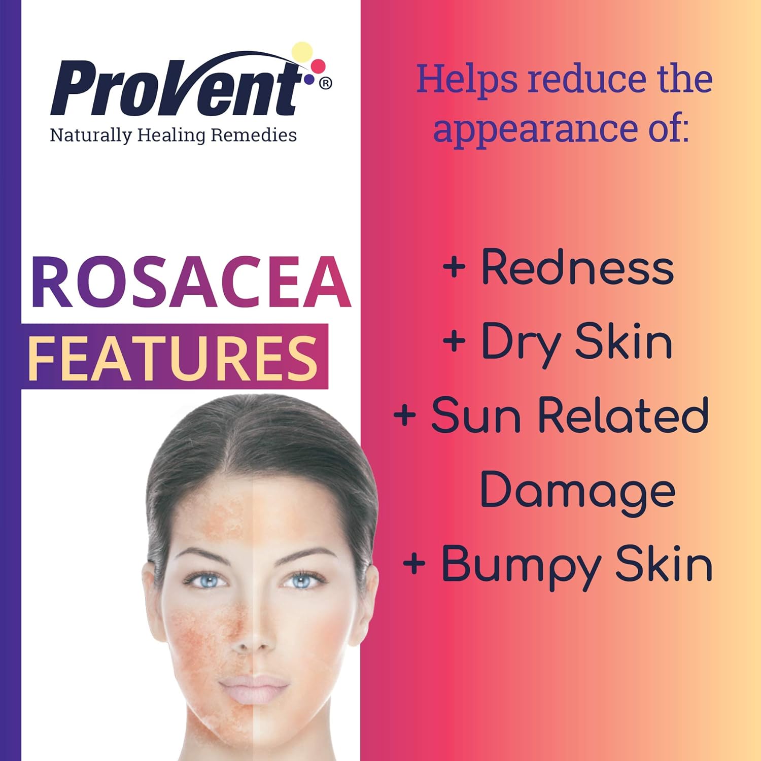provent rosacea cream