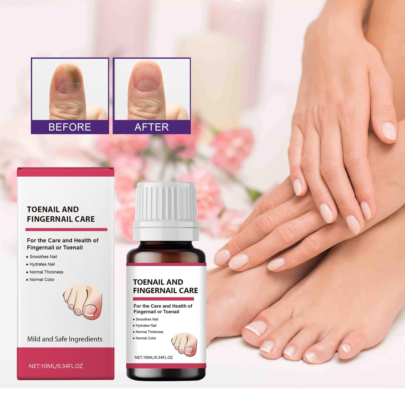 Toenail Fungus Treatment Extra Strength, Nail Fungus Treatment for Toenail,Toenail Fungus Treatments,Natural Ingredients 2 Bottles - Image 5