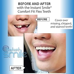 Instant Smile Flex Teeth (Natural Shade) and Pro