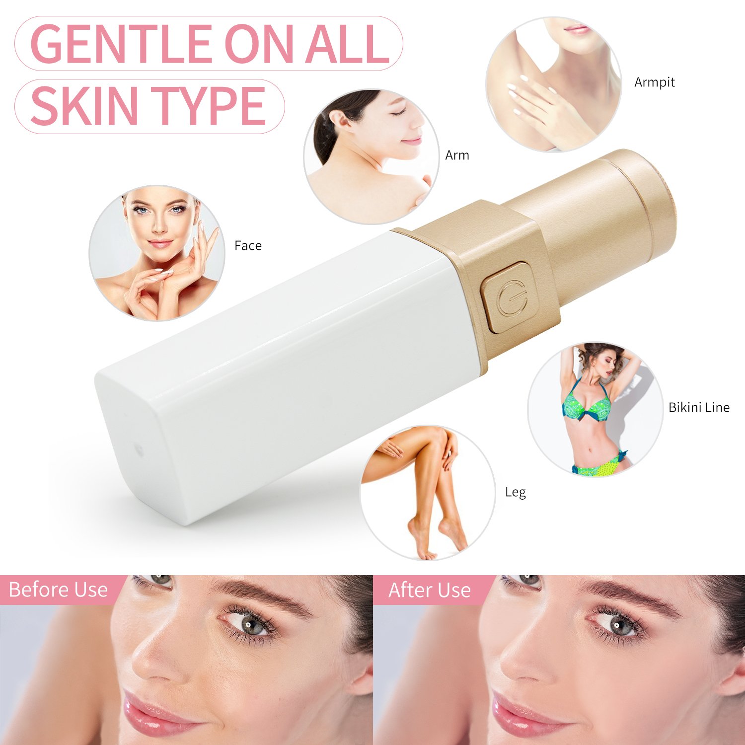 Facial Hair Removal for Women,Sunvito Women\'s Lipstick Razor Electric Shaver Painless Remove Hairs on the Face, Legs, Hands, Bikini Parts And Private Parts