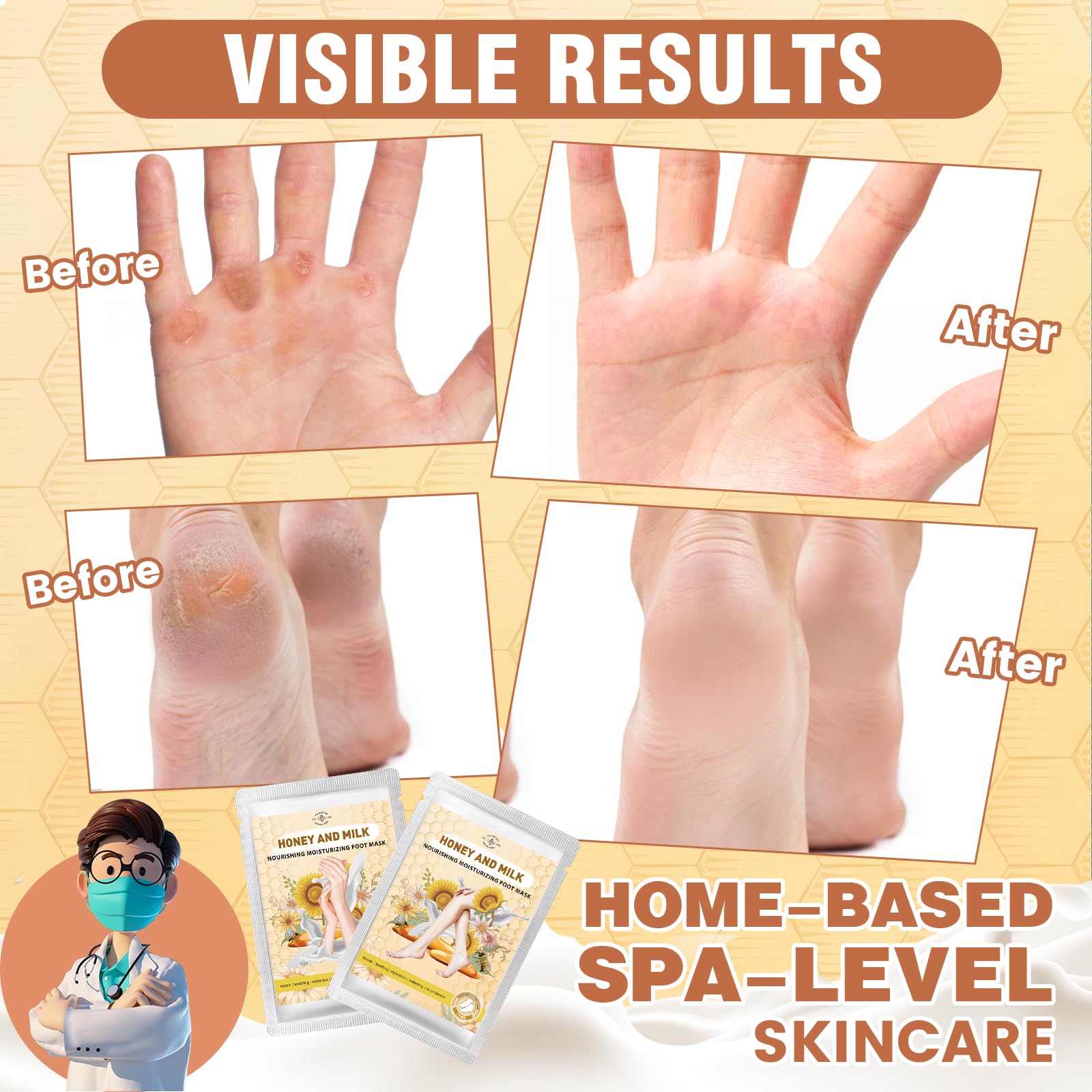 Hydrating Hand and Foot Mask, 3 Foot & 3 Hand Mask, Hand and Foot Care After Pedicure, Moisturizing Socks for Dry, Cracked Heel, Foot Spa, Honey & Milk, Vitamin E