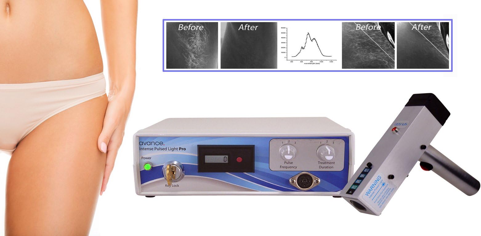 Máquina Profesional de la electrólisis del Laser del IPL para el Pelo permanente del Laser, tatuaje, vena, Punto de la edad, eliminación de la cicatriz