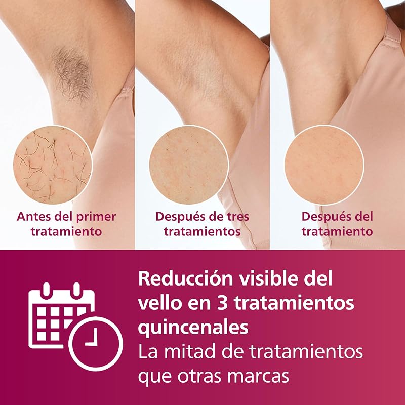 Lumea serie 7000, dispositivo de depilación IPL, alternativa de depilación láser, 3 accesorios para el cuerpo, la cara y la zona del bikini, modelo SC1999/00