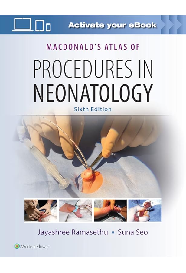 Neurology of the Newborn 英語版 Neurology of the Newborn, 5e (Volpe, Neurology of the Newborn) 5th