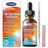 Ingrown Toenail Relief: Ingrown Toenail Tool for