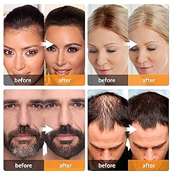 Abomet Root Touch Up Instantly Gray Hair Coverage