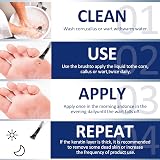 MYMULIKE Liquid for Corn Removers Extra Strength Foot Pain Relief 15ML view 5