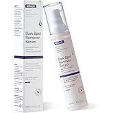 Dark Spot Remover for Face, Dark Spot Corrector - Age Spot Sun Spot Freckles Melasma Brown Spot, Natural Formula: Soothing and Repairing, Anti-Aging and Antioxidant Properties